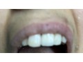 clinique-dentaire-dr-filali-baba-khalid-47-boulevard-mohamed-cinq-tanger-small-1