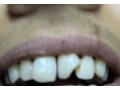 clinique-dentaire-dr-filali-baba-khalid-47-boulevard-mohamed-cinq-tanger-small-0