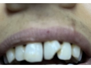 Clinique Dentaire Dr Filali Baba Khalid 47 Boulevard Mohamed cinq Tanger