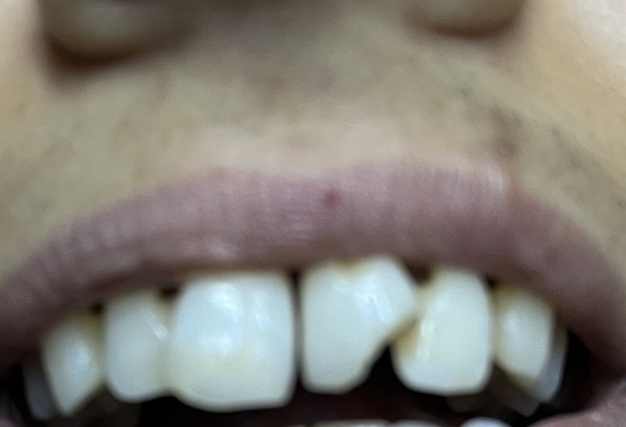 clinique-dentaire-dr-filali-baba-khalid-47-boulevard-mohamed-cinq-tanger-big-0